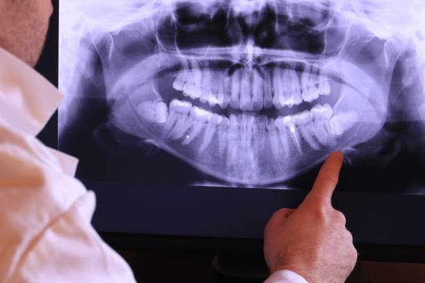 Best Emergency Treatment for Dental Infections or Abscesses in Roaming Shores, OH