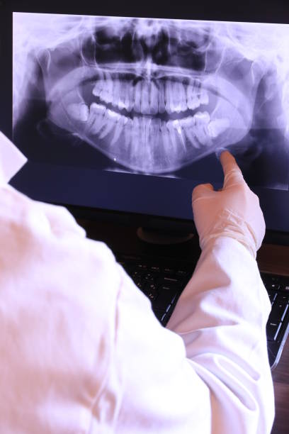 Best Emergency Treatment for Dental Infections or Abscesses in Roaming Shores, OH