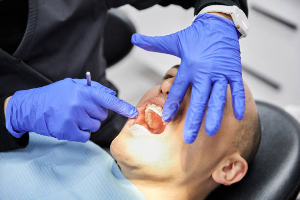 Best Emergency Treatment for Dental Infections or Abscesses in Roaming Shores, OH